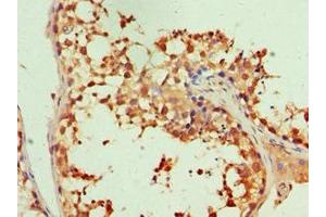 Immunohistochemistry of paraffin-embedded human testis tissue using ABIN7156485 at dilution of 1:100 (Integrin beta 3 抗体  (AA 609-788))
