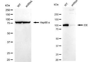 Western blotting analysis using IDE antibody (ABIN7799047). (Recombinant IDE 抗体)
