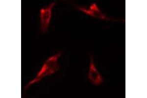 ABIN6275227 staining  Hela cells by IF/ICC. (MBTPS1 抗体  (Internal Region))