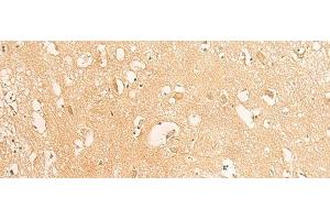 Immunohistochemistry of paraffin-embedded Human brain tissue using IFITM2 Polyclonal Antibody at dilution of 1:25(x200) (IFITM2 抗体)