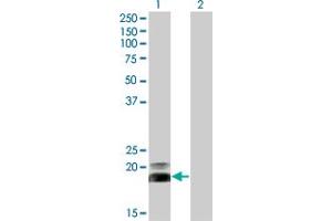 Western Blot analysis of HAND2 expression in transfected 293T cell line by HAND2 monoclonal antibody (M06), clone 3D5. (HAND2 抗体  (AA 135-216))