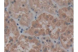 Detection of AATK in Human Kidney Tissue using Polyclonal Antibody to Apoptosis Associated Tyrosine Kinase (AATK) (AATK 抗体  (AA 1216-1374))