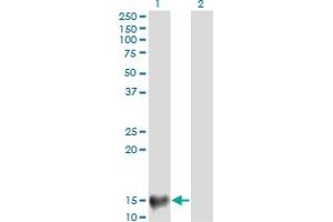 Western Blotting (WB) image for anti-Mediator Complex Subunit 21 (MED21) (AA 1-144) antibody (ABIN522871)