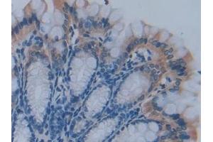 Immunohistochemistry (IHC) image for anti-phosphofructokinase, Platelet (PFKP) (AA 247-473) antibody (ABIN7443050)
