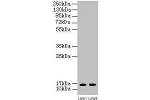 Western blot All lanes: LSM4 antibody at 2 μg/mL Lane 1: A549 whole cell lysate Lane 2: K562 whole cell lysate Secondary Goat polyclonal to rabbit IgG at 1/10000 dilution Predicted band size: 16 kDa Observed band size: 16 kDa (LSM4 抗体  (AA 1-139))