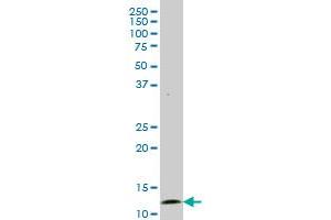 GHRL monoclonal antibody (M06), clone 4E5. (Ghrelin 抗体  (AA 1-117))