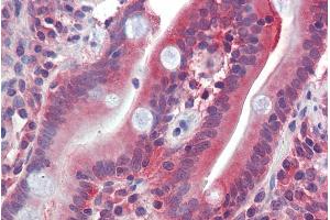 Immunohistochemistry (IHC) image for anti-Solute Carrier Family 2 (Facilitated Glucose/fructose Transporter), Member 5 (SLC2A5) (C-Term) antibody (ABIN570764)