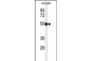 Western blot analysis of TNFRSF8- (ABIN651104 and ABIN2840072) in mouse liver tissue lysates (35 μg/lane).