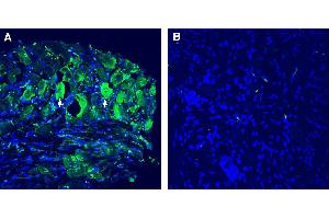 Expression of TMEM150C in rat dorsal root ganglia (DRG). (TMEM150C 抗体  (Extracellular))
