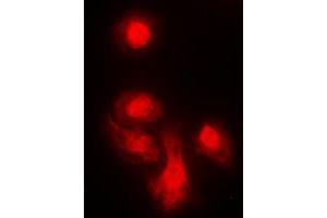 Immunofluorescent analysis of KIF4A staining in MCF7 cells. (KIF4A 抗体  (C-Term))