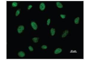 Immunostaining analysis in HeLa cells. (BRD3 抗体)