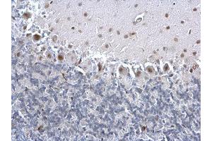 Immunohistochemistry (IHC) image for anti-Proliferating Cell Nuclear Antigen (PCNA) antibody (ABIN2854788)