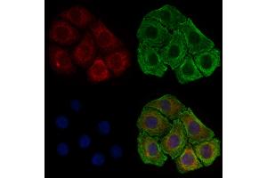 ABIN6257373 and ABIN6274770 staining HepG2 cells by IF/ICC. (RPL17 抗体  (C-Term))