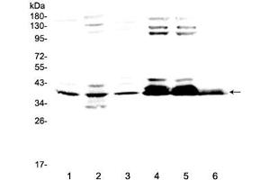 Western blot testing of 1) rat brain, 2) rat testis, 3) mouse brain, 4) human 293T, 5) human 293T and 6) human HepG2 lysate at 0. (MSI1 抗体  (AA 21-54))