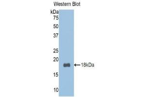Detection of Recombinant TCF20, Mouse using Polyclonal Antibody to Transcription factor 20 (TCF20) (TCF20 抗体  (AA 392-524))