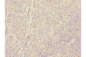 Immunohistochemistry of paraffin-embedded human tonsil tissue using ABIN7147360 at dilution of 1:100 (CENPH 抗体  (AA 1-247))