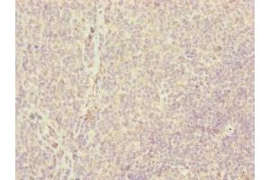 Immunohistochemistry of paraffin-embedded human tonsil tissue using ABIN7147360 at dilution of 1:100 (CENPH 抗体  (AA 1-247))
