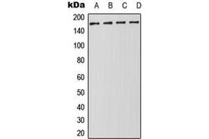 Western blot analysis of DROSHA expression in Jurkat (A), HeLa (B), NIH3T3 (C), PC12 (D) whole cell lysates. (DROSHA 抗体  (Center))