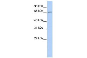 ACOT12 antibody used at 1 ug/ml to detect target protein. (ACOT12 抗体  (Middle Region))