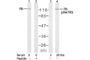 Image no. 2 for anti-Retinoblastoma 1 (RB1) (pSer780) antibody (ABIN196842)