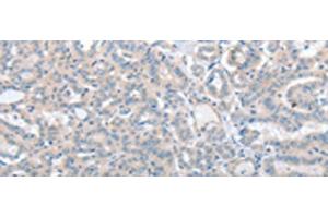 Immunohistochemistry (Paraffin-embedded Sections) (IHC (p)) image for anti-Solute Carrier Family 17 (Vesicular Glutamate Transporter), Member 6 (SLC17A6) antibody (ABIN7254220)