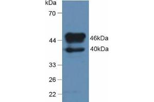 Detection of TBG in Rat Brain Tissue using Polyclonal Antibody to Thyroxine Binding Globulin (TBG) (SERPINA7 抗体  (AA 114-391))