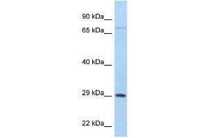 WB Suggested Anti-F11R Antibody Titration: 1. (F11R 抗体  (C-Term))