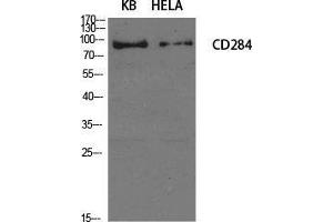 Western Blot (WB) analysis of specific cells using CD284 Polyclonal Antibody. (TLR4 抗体  (Internal Region))