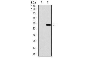 Image no. 1 for anti-Protein Phosphatase, Mg2+/Mn2+ Dependent, 1A (PPM1A) antibody (ABIN1491178) (PPM1A 抗体)