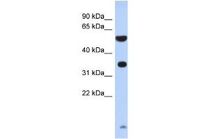 WB Suggested Anti-ESSPL Antibody Titration: 0. (ESSPL 抗体  (N-Term))