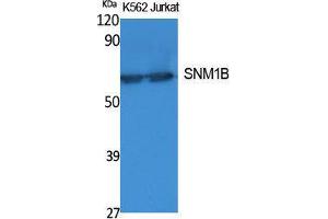 Western Blotting (WB) image for anti-DNA Cross-Link Repair 1B (DCLRE1B) (C-Term) antibody (ABIN3187627) (DCLRE1B 抗体  (C-Term))