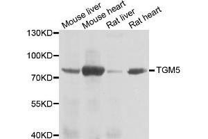 Western blot analysis of extracts of various cell lines, using TGM5 antibody. (Transglutaminase 5 抗体)