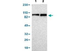 Western Blot analysis of (1) human cell line RT-4, and (2) human cell line U-251MG sp. (KIF2A 抗体  (AA 35-144))