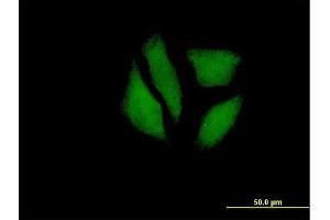 Immunofluorescence of purified MaxPab antibody to MGC5987 on HeLa cell. (MDP1 抗体  (AA 1-176))