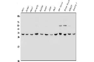 Western blot analysis of YWHAE using anti-YWHAE antibody (ABIN7599166).