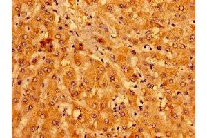 Immunohistochemistry of paraffin-embedded human liver tissue using ABIN7158957 at dilution of 1:100 (MCAT 抗体  (AA 22-117))