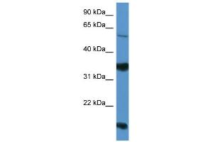 WB Suggested Anti-NTNG2 Antibody Titration: 0. (Netrin G2 抗体  (Middle Region))