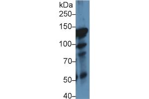 Detection of ITIH4 in Rat Lung lysate using Polyclonal Antibody to Inter Alpha-Globulin Inhibitor H4 (ITIH4) (ITIH4 抗体  (AA 478-722))