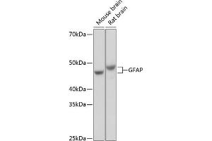 Western blot analysis of extracts of various cell lines, using GFAP antibody (ABIN7267389) at 1:1000 dilution. (GFAP 抗体)