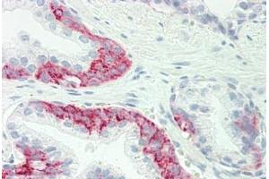 Human Prostate: Formalin-Fixed, Paraffin-Embedded (FFPE) (GJC1 抗体  (Asn361))