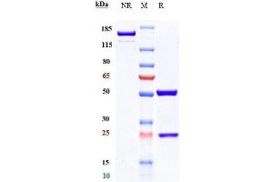 Anti-TNFRSF10B / TRAILR2 / CD262 Reference Antibody (conatumumab) on SDS-PAGE under reducing (R) condition.
