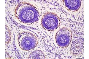 Immunohistochemistry (IHC) image for anti-Myosin Heavy Chain 1, Skeletal Muscle, Adult (MYH1) (AA 901-1000) antibody (ABIN759326)