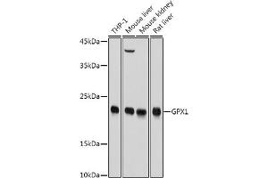 Western blot analysis of extracts of various cell lines, using GPX1 antibody (ABIN3021455, ABIN3021456, ABIN3021457, ABIN1512957 and ABIN6215063) at 1:1000 dilution. (Glutathione Peroxidase 1 抗体  (AA 50-203))