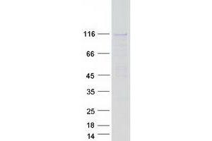Validation with Western Blot