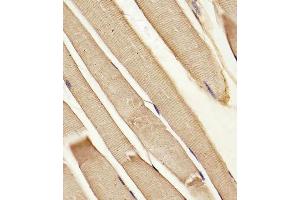 Immunohistochemistry (Paraffin-embedded Sections) (IHC (p)) image for anti-ATP-Binding Cassette, Sub-Family B (MDR/TAP), Member 10 (ABCB10) (AA 1-27), (N-Term) antibody (ABIN652180)