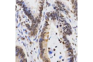 Immunohistochemistry (Paraffin-embedded Sections) (IHC (p)) image for anti-Histone 3 (H3) (H3K9me2) antibody (ABIN3023260)