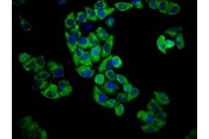 Immunofluorescence staining of Hela cells with ABIN7164473 at 1:100, counter-stained with DAPI.