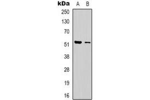 Western blot analysis of Dematin expression in Jurkat (A), HEK293T (B) whole cell lysates.