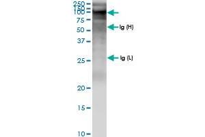 Immunoprecipitation of ZFYVE9 transfected lysate using anti-ZFYVE9 MaxPab rabbit polyclonal antibody and Protein A Magnetic Bead , and immunoblotted with ZFYVE9 MaxPab rabbit polyclonal antibody (D01) . (ZFYVE9 抗体  (AA 1-762))