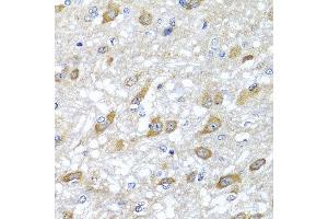 Immunohistochemistry of paraffin-embedded rat brain using HSPA6 antibody at dilution of 1:100 (x40 lens). (HSPA6 抗体)